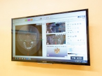 お口の状態の検査イメージ画像