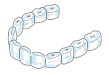 マウスピースの作製イメージ画像